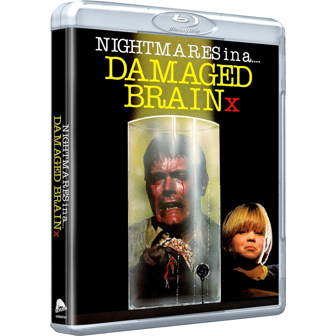 Nightmares in a Damaged Brain [Blu-ray]